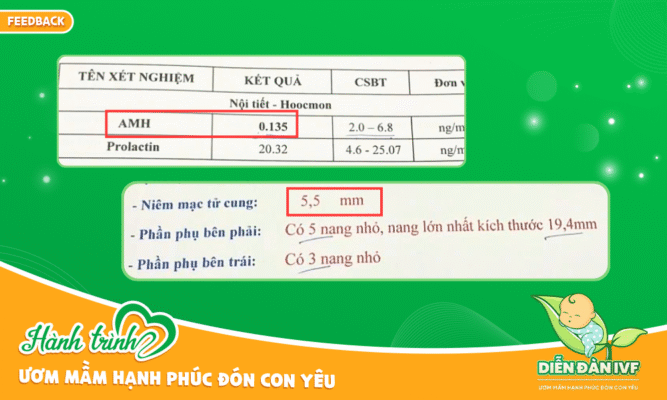 Kết quả xét nghiệm AMH và niêm mạc của chị Tuyết Lê