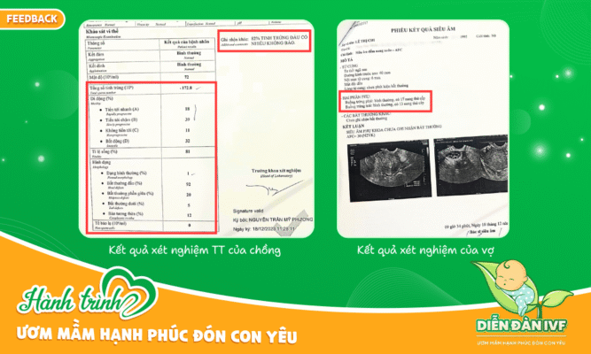 Kết quả xét nghiệm tinh trùng và trứng, bước khởi đầu cho hành trình ươm mầm